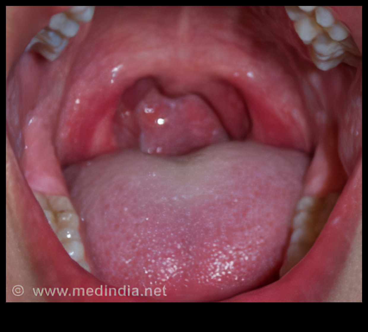 Papile gustative mici, potențial mare: măiestria nutriției pediatrice